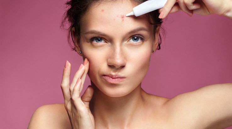 21611-garnier-rewrites-skincare-solutions-for-adult-acne_eng